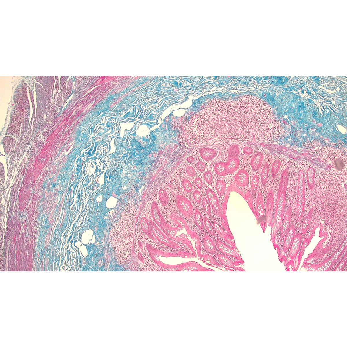 Masson's Trichrome